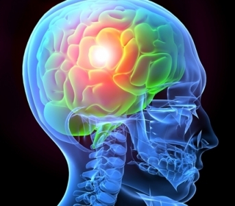 Risk for Seizures After a Traumatic Brain Injury